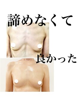 サロンツキ(salon tuki)/【バストケア】症例★