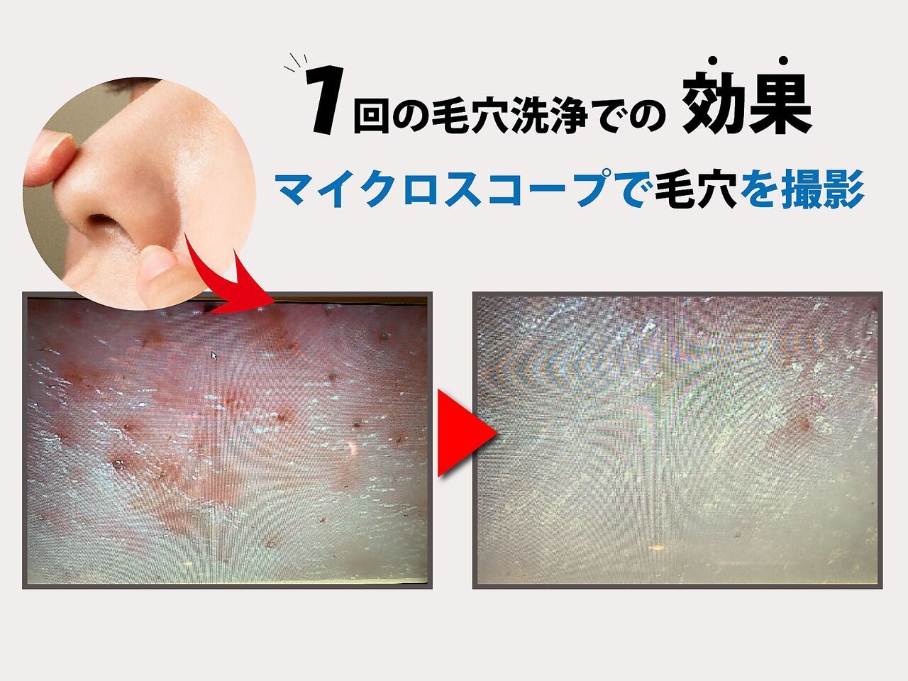 専用出品　Deep ジェンティール　エクストラオイル　EBM エステ　サロン 専用出品 Deep ジェンティール エクストラオイル EBM エステ サロン