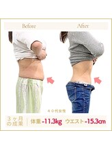 アロハ(ALOHA.)/ぽっこりお腹やお尻の贅肉解消！