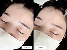 エムドット(m.)/アイブロウワックス脱毛