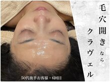 クラヴェル(Clavel)
