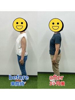 サンシー整体(SunCY整体)/腸もみで姿勢も改善!