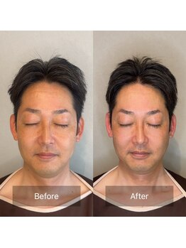 小顔矯正&美容整体サロン Still U 渋谷/男性におすすめ♪