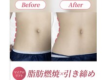 【小顔・痩身専門店】Lift静岡【6/30 OPEN（予定）】の雰囲気（韓国で話題、日本でも大バズリの痩身マシン☆脂肪のみを狙い撃ち）