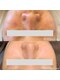 エステサロン ’Olu ’Oluの写真/その毛穴悩み、諦めないで!黒ずみ・開きを徹底改善。ハーブの力で毛穴レスなツヤ肌へ導きます