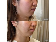 サロン モジョ(mojo)の雰囲気(即時に実感!リバウンドしにくい小顔術は幅広いお客様に大人気◎)