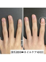 桃の木 吉祥寺店/#自爪育成　4