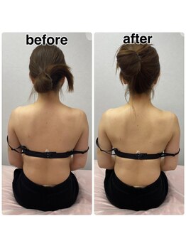 ノゾミジュク(希美熟 NOZOMIJUKU)/肩凝り改善