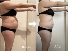 ヨサパーク ナナラーレア 福島店(YOSA PARK nanala lea)/痩身/ダイエット/リンパ/産後