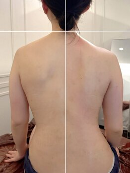 心斎橋 ルヴィ(REVI)の写真/「えっ!? これで痩せるの!?」関西発!!姿勢から変わる全身ダイエット★バランスを整え根本から痩せボディに!