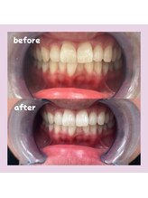 パレ 大阪十三店(Palet)/before/after