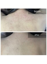 素肌研究所BSラボ/