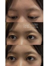 ビューティマーケット アングゥ(BEAUTY MARKET ungu)/メーテルラッシュ