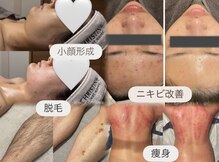 エクラ(eclat)