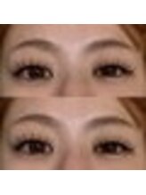 バニーアイズ 天神(Bunny eyes TENJIN)/フラット140本