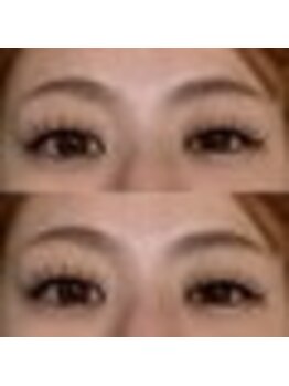 バニーアイズ 天神(Bunny eyes TENJIN)/フラット140本