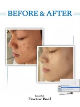 ドルチェビューティーサロン 戸塚安行店(Dolce Beauty Salon)/ダクトピール