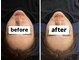 ソセイラボ ウェルネス(SOSEI Lab. wellness)の写真/【美腸鍼×腸もみで体の内側から美しい肌に!】1人1人のお悩みを見極め、しっかりアプローチ◎