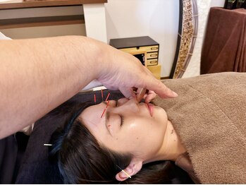 たかはし治療院/全身から整える美容鍼