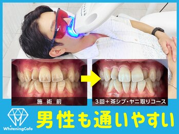 ホワイトニングカフェ アスピア明石店(WhiteningCafe)/男性のお客様も増えています♪