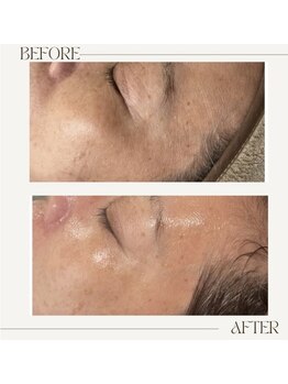 アンド(&.)/before/after