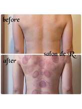 サロン ド アール(salon de R.)/【お背中骨氣・30代・施術効果】