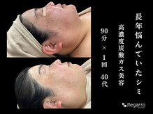 レガロビューティクリエイションズ桜川店/シミに終止符！シミを作らない肌
