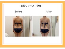 リヴェーヌ 富山店/筋膜リリース1回