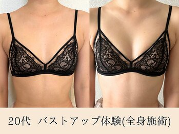 ラーナ(Lana)/【バストアップ】症例