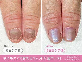 Before/After【feerie立川】