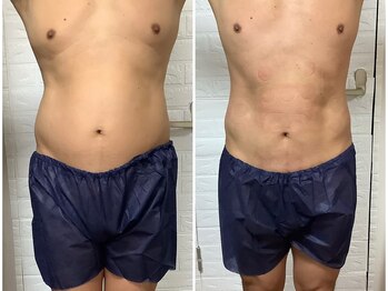 ビューティフルムーン(Beautiful Moon)/男性も歓迎☆お腹冷却増えてます