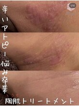 ビジュープラス ひたち野うしく店(Bijou+)/