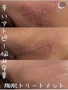 ビジュープラス ひたち野うしく店(Bijou+)/