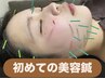 【女性限定♪はじめての美容鍼】40分　¥4980
