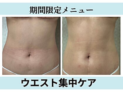 エクラニーク(Eclanique)の写真