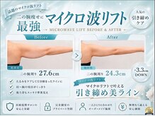 クロエビューティー 麻布十番店(クロエbeauty)の雰囲気(毛穴/ララピール/ニキビ/ピーリング/マイクロ波リフト/脱毛)