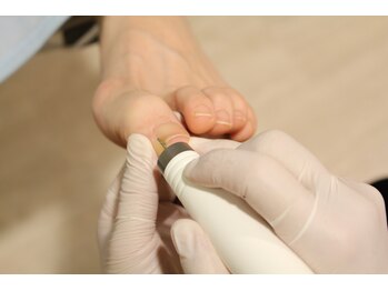 ぱれっと/【フットケア】爪のお手入れ３