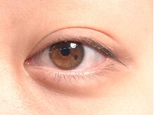 クイント(quint:)/before