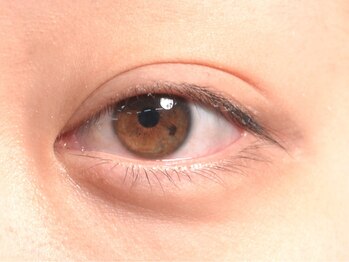 クイント(quint:)/before