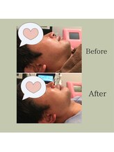 ウナ デ リンゴル 恵比寿店(UNA de Ringol)/メンズOK！清潔感UP！！