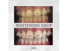 ホワイトニングショップ 徳島店の雰囲気（矯正中でもホワイトニング可能◎#ホワイトニング#徳島）