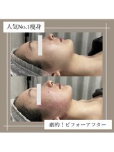 アーネスト 夙川店(EARNEST)/比較写真