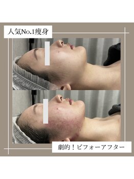 アーネスト 夙川店(EARNEST)/比較写真