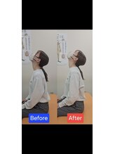 最後の整体 練馬駅前院/肩こりでお悩みの方の可動域
