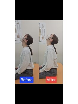 最後の整体 練馬駅前院/肩こりでお悩みの方の可動域