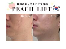 ナビ(NAVI)/韓国最新リフトアップ機械！