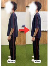 ネーム鍼灸整骨院 春日 本郷三丁目院/首肩痛でお悩みだったKさん