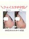 グラシア(gracia)の写真/ラジオ波でハリ・弾力ケア！しわ・たるみを予防して若々しい印象の肌へ♪