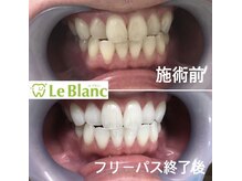 ルブラン 奈良店(Le Blanc)/初回ご来店のお客様へ！