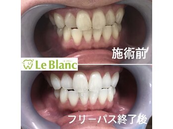 ルブラン 奈良店(Le Blanc)/初回ご来店のお客様へ!